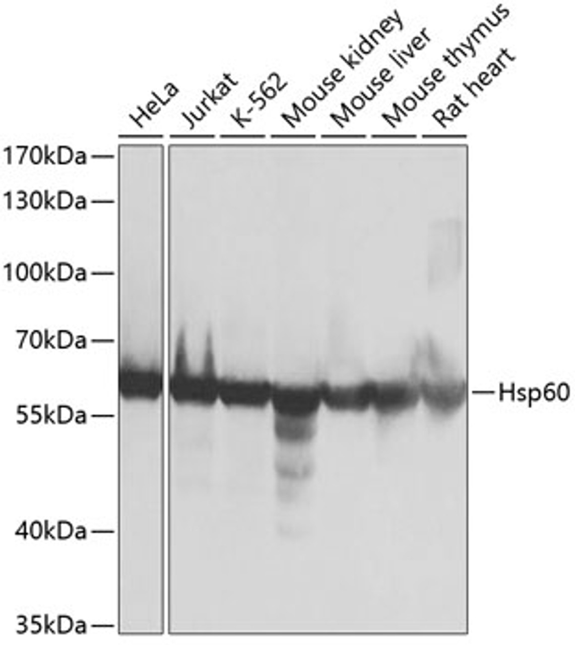 Western blot analysis of extracts of various cell lines, using Hsp60 antibody (13-342) at 1:1000 dilution.<br/>Secondary antibody: HRP Goat Anti-Rabbit IgG (H+L) at 1:10000 dilution.<br/>Lysates/proteins: 25ug per lane.<br/>Blocking buffer: 3% nonfat dry milk in TBST.<br/>Detection: ECL Basic Kit.<br/>Exposure time: 10s.