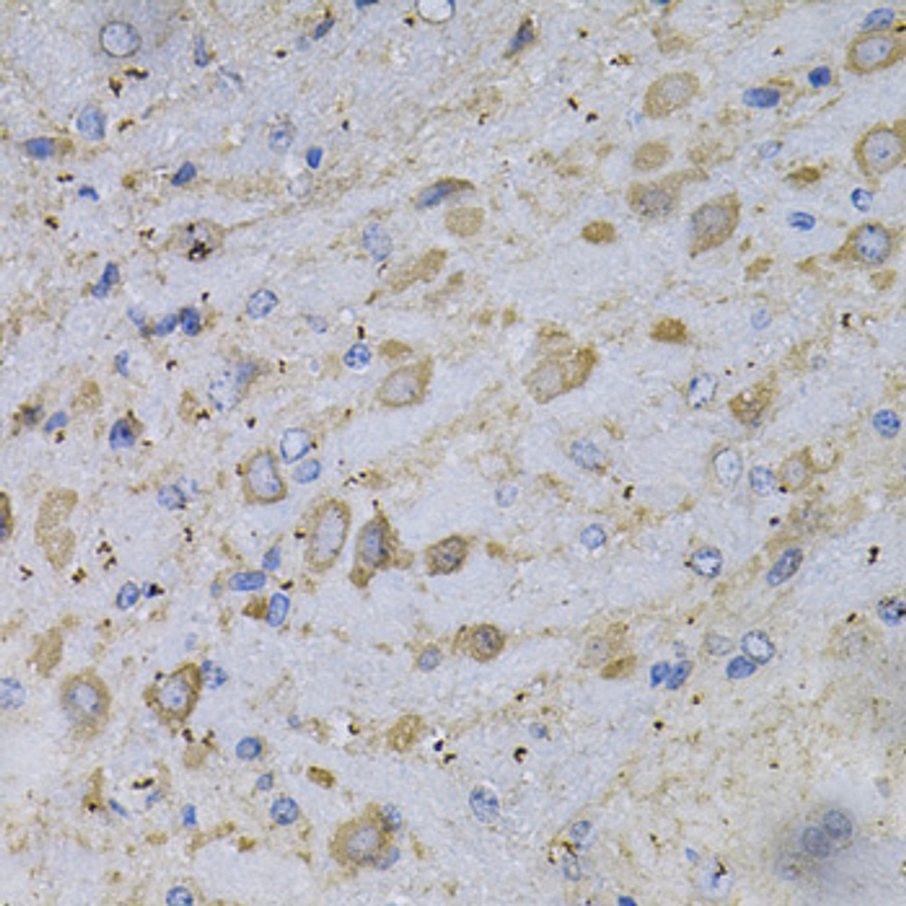 Immunohistochemistry of paraffin-embedded rat brain using GAD2 Antibody (13-343) at dilution of 1:100 (40x lens) .