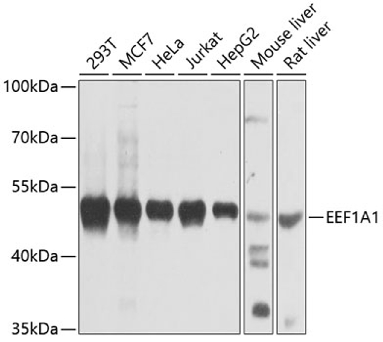 Western blot analysis of extracts of various cell lines, using EEF1A1 antibody (13-345) at 1:1000 dilution.<br/>Secondary antibody: HRP Goat Anti-Rabbit IgG (H+L) at 1:10000 dilution.<br/>Lysates/proteins: 25ug per lane.<br/>Blocking buffer: 3% nonfat dry milk in TBST.<br/>Detection: ECL Basic Kit.<br/>Exposure time: 10s.