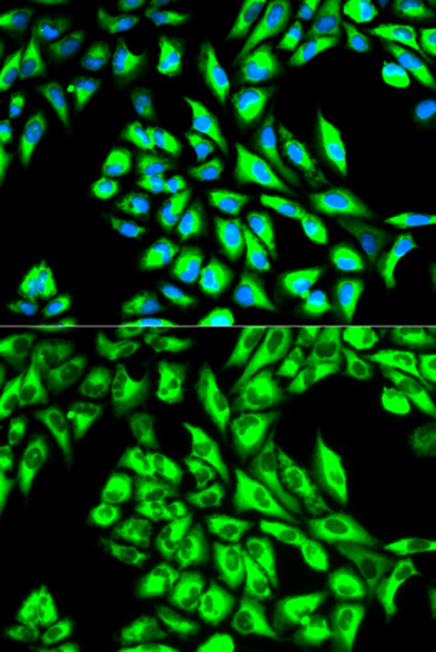 Immunofluorescence analysis of HeLa cells using EEF1A1 antibody (13-345) . Blue: DAPI for nuclear staining.