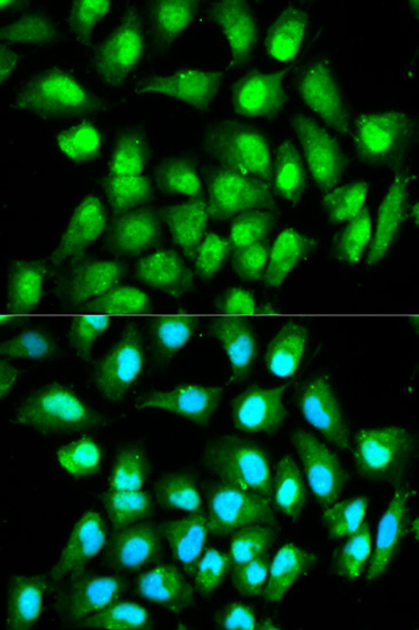 Immunofluorescence analysis of HeLa cells using RAN antibody (13-347) . Blue: DAPI for nuclear staining.