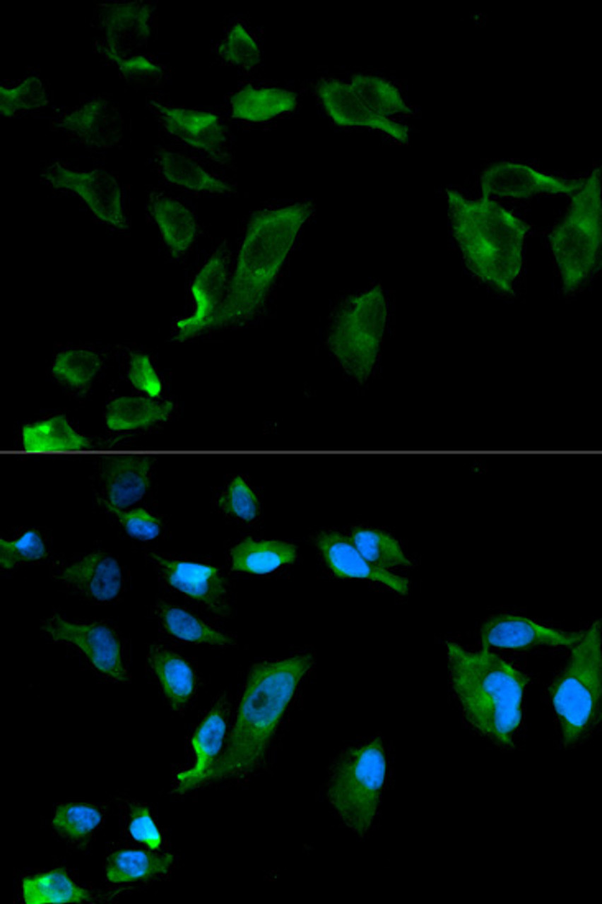 Immunofluorescence analysis of HeLa cells using NEK8 antibody (13-353) . Blue: DAPI for nuclear staining.