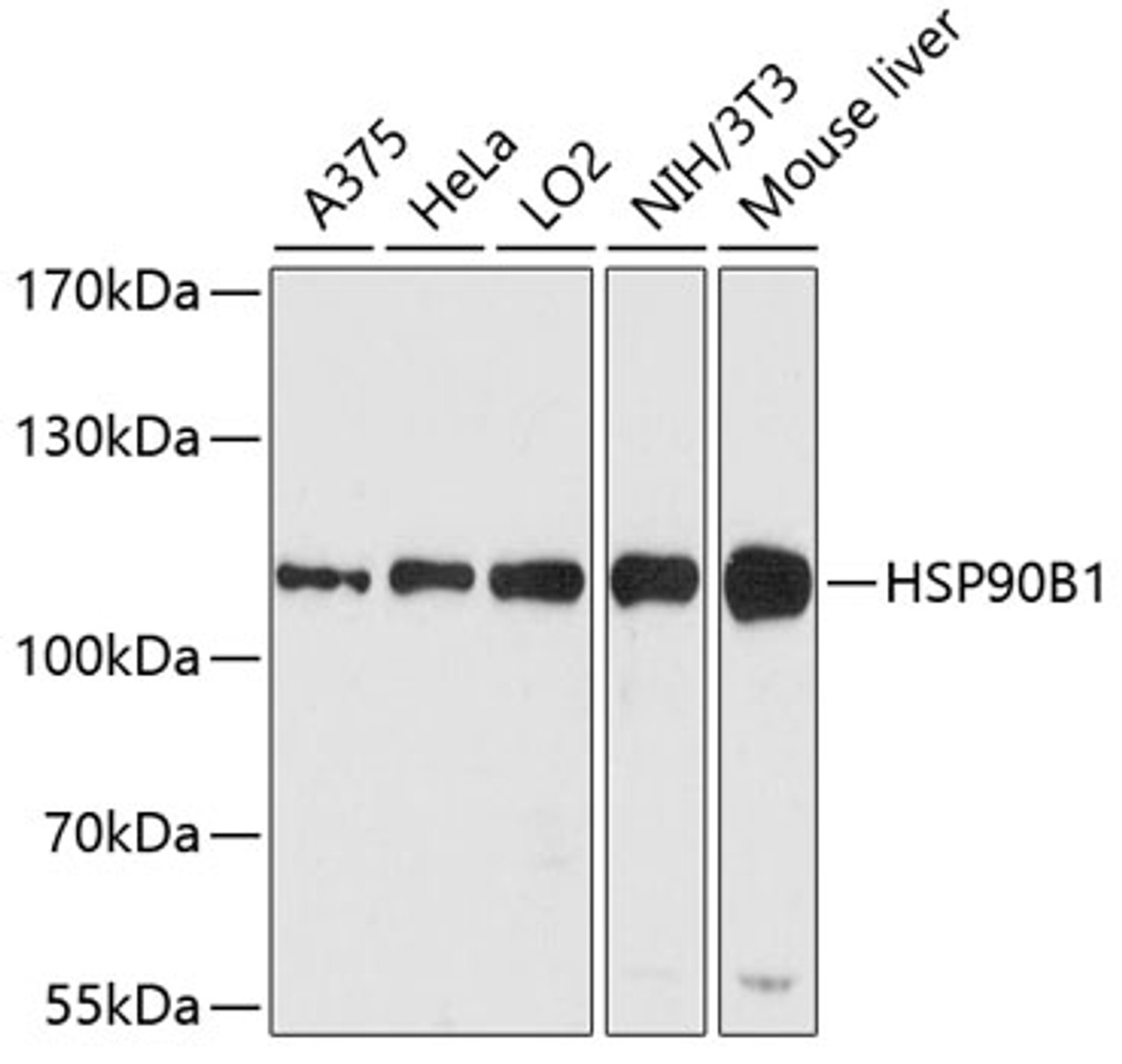 Western blot analysis of extracts of various cell lines, using HSP90B1 antibody (13-356) at 1:1000 dilution.<br/>Secondary antibody: HRP Goat Anti-Rabbit IgG (H+L) at 1:10000 dilution.<br/>Lysates/proteins: 25ug per lane.<br/>Blocking buffer: 3% nonfat dry milk in TBST.<br/>Detection: ECL Enhanced Kit.<br/>Exposure time: 90s.