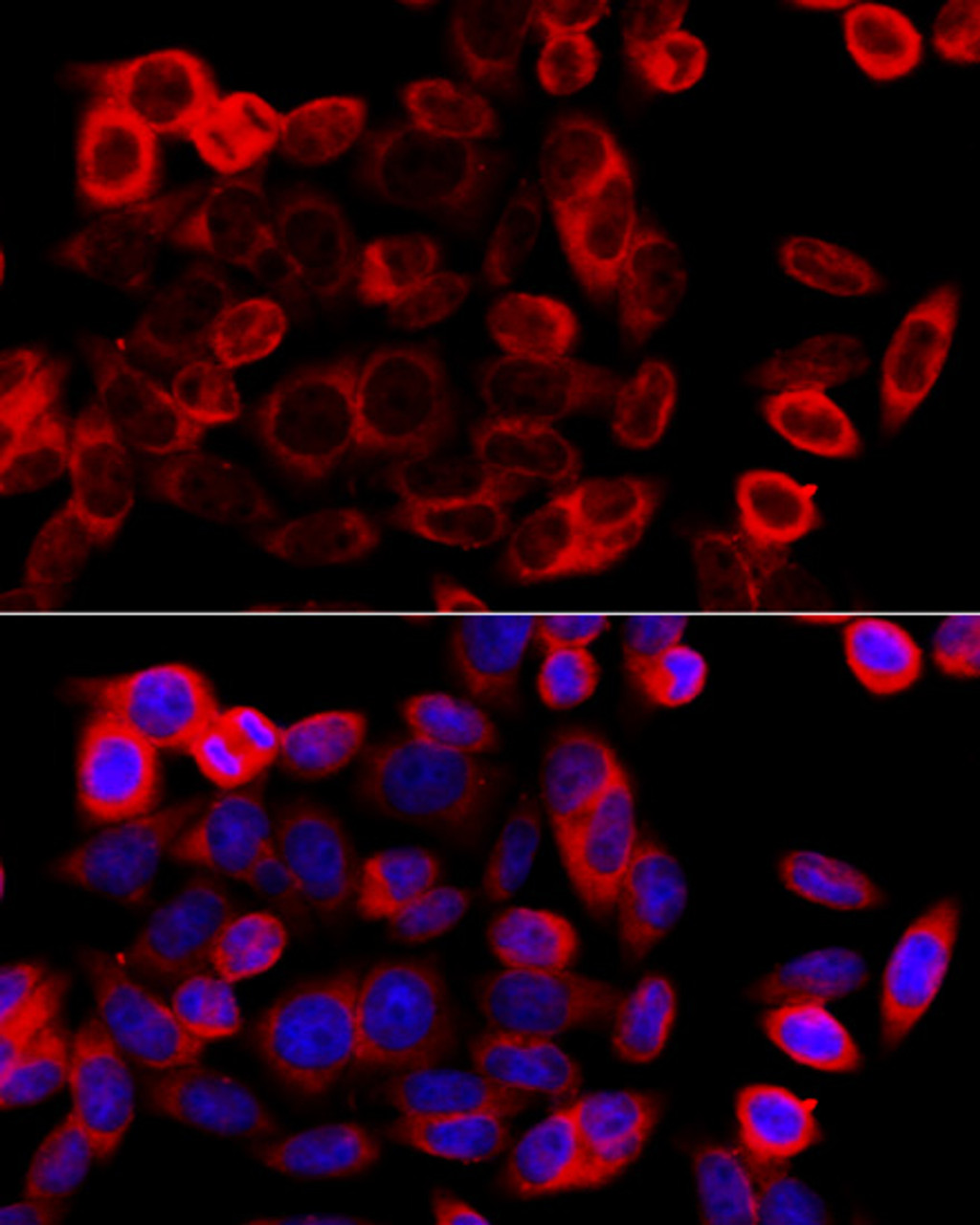 Immunofluorescence analysis of HeLa cells using HSP90B1 antibody (13-356) at dilution of 1:100 (40x lens) . Blue: DAPI for nuclear staining.