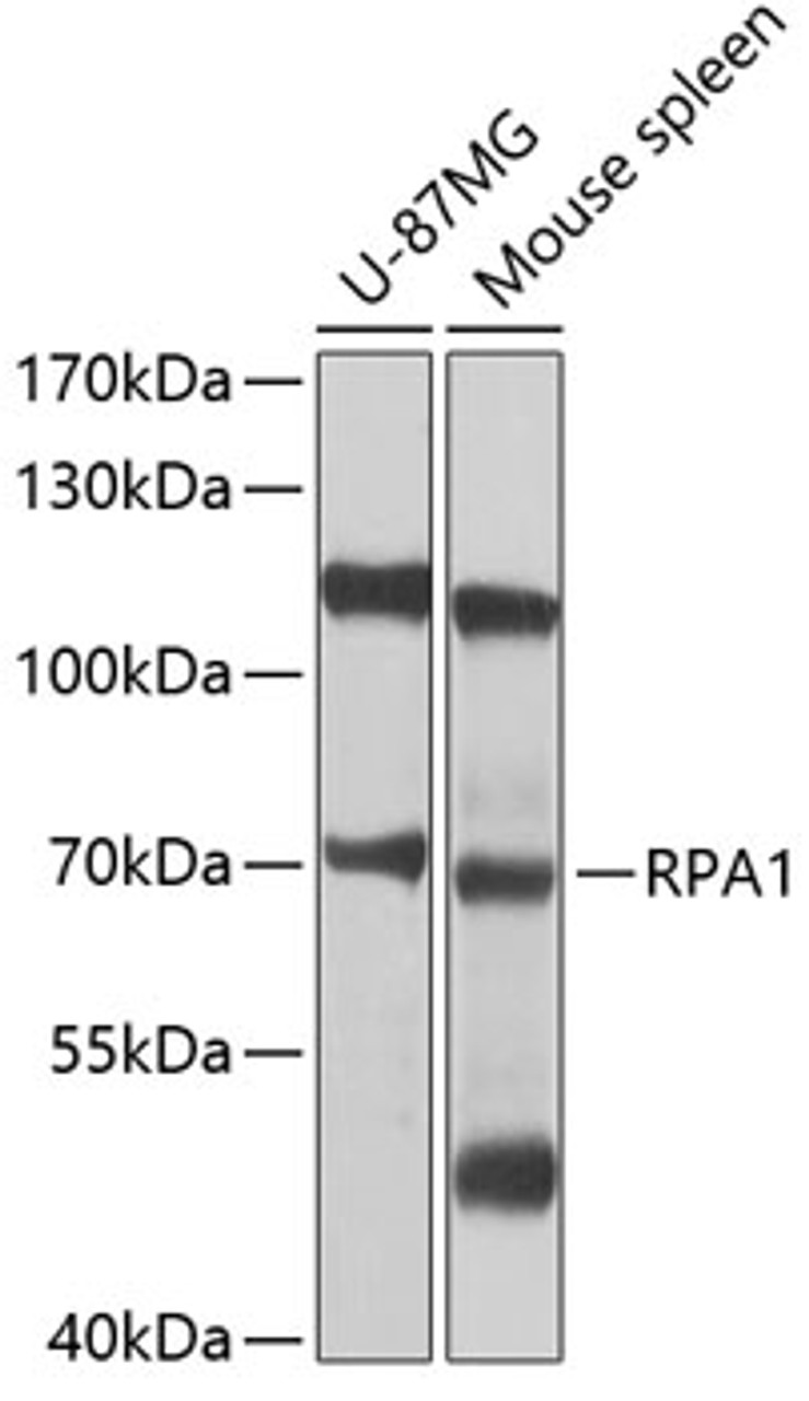 Western blot analysis of extracts of various cell lines, using RPA1 antibody (13-357) at 1:1000 dilution.<br/>Secondary antibody: HRP Goat Anti-Rabbit IgG (H+L) at 1:10000 dilution.<br/>Lysates/proteins: 25ug per lane.<br/>Blocking buffer: 3% nonfat dry milk in TBST.<br/>Detection: ECL Basic Kit.<br/>Exposure time: 1s.