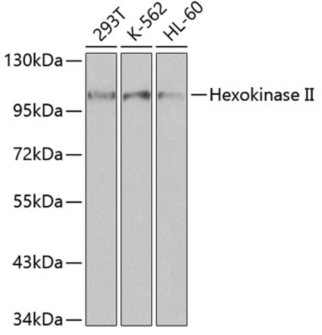 Western blot analysis of extracts of various cell lines, using Hexokinase II antibody (13-360) at 1:1000 dilution.<br/>Secondary antibody: HRP Goat Anti-Rabbit IgG (H+L) at 1:10000 dilution.<br/>Lysates/proteins: 25ug per lane.<br/>Blocking buffer: 3% nonfat dry milk in TBST.