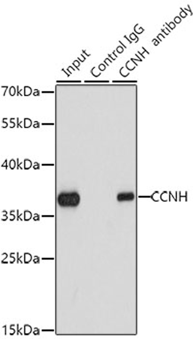 Immunoprecipitation analysis of 200ug extracts of K562 cells using 1ug CCNH antibody (13-361) . Western blot was performed from the immunoprecipitate using CCNH antibody (13-361) at a dilition of 1:1000.