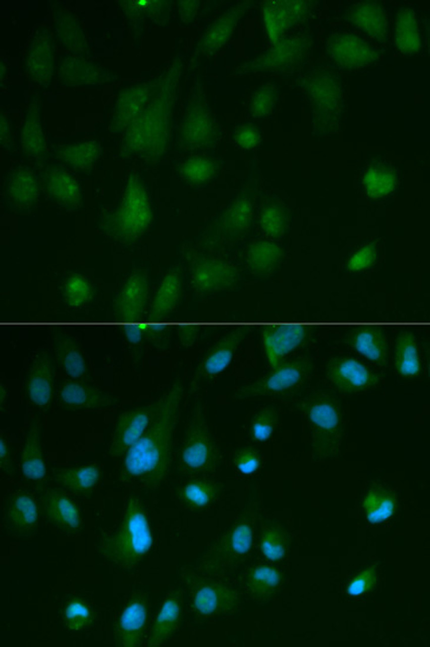 Immunofluorescence analysis of HeLa cells using ARRB1 antibody (13-363) . Blue: DAPI for nuclear staining.