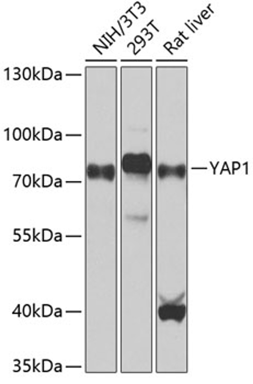 Western blot analysis of extracts of various cell lines, using YAP1 antibody (13-370) at 1:1000 dilution.<br/>Secondary antibody: HRP Goat Anti-Rabbit IgG (H+L) at 1:10000 dilution.<br/>Lysates/proteins: 25ug per lane.<br/>Blocking buffer: 3% nonfat dry milk in TBST.<br/>Detection: ECL Basic Kit.<br/>Exposure time: 90s.