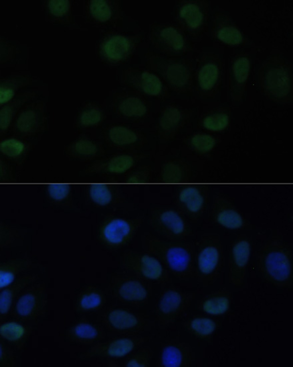 Immunofluorescence analysis of HeLa cells using KLF6 antibody (13-372) at dilution of 1:100. Blue: DAPI for nuclear staining.