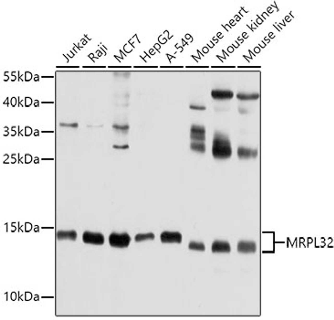 Western blot analysis of extracts of various cell lines, using MRPL32 antibody (13-376) at 1:1000 dilution.<br/>Secondary antibody: HRP Goat Anti-Rabbit IgG (H+L) at 1:10000 dilution.<br/>Lysates/proteins: 25ug per lane.<br/>Blocking buffer: 3% nonfat dry milk in TBST.<br/>Detection: ECL Basic Kit.<br/>Exposure time: 10s.