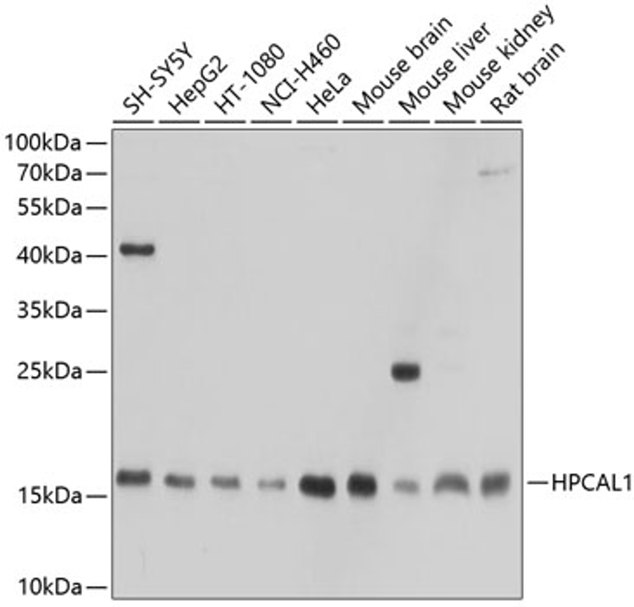 Western blot analysis of extracts of various cell lines, using HPCAL1 antibody (13-378) at 1:1000 dilution.<br/>Secondary antibody: HRP Goat Anti-Rabbit IgG (H+L) at 1:10000 dilution.<br/>Lysates/proteins: 25ug per lane.<br/>Blocking buffer: 3% nonfat dry milk in TBST.<br/>Detection: ECL Basic Kit.<br/>Exposure time: 30s.