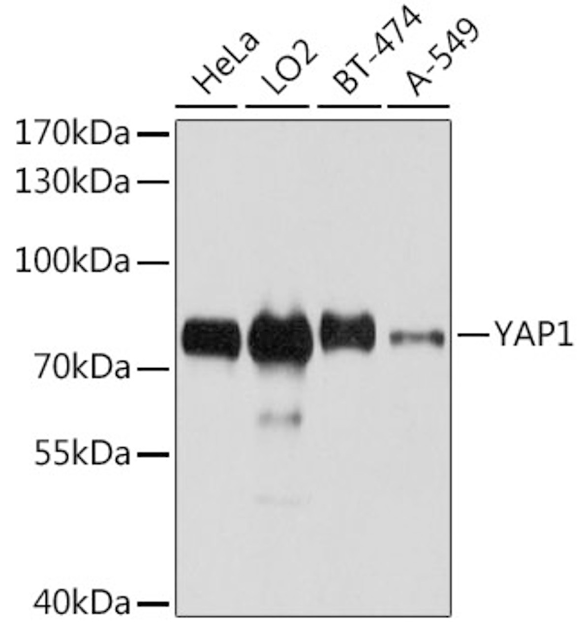 Western blot analysis of extracts of various cell lines, using YAP1 antibody (13-379) at 1:1000 dilution.<br/>Secondary antibody: HRP Goat Anti-Rabbit IgG (H+L) at 1:10000 dilution.<br/>Lysates/proteins: 25ug per lane.<br/>Blocking buffer: 3% nonfat dry milk in TBST.<br/>Detection: ECL Basic Kit.<br/>Exposure time: 10s.