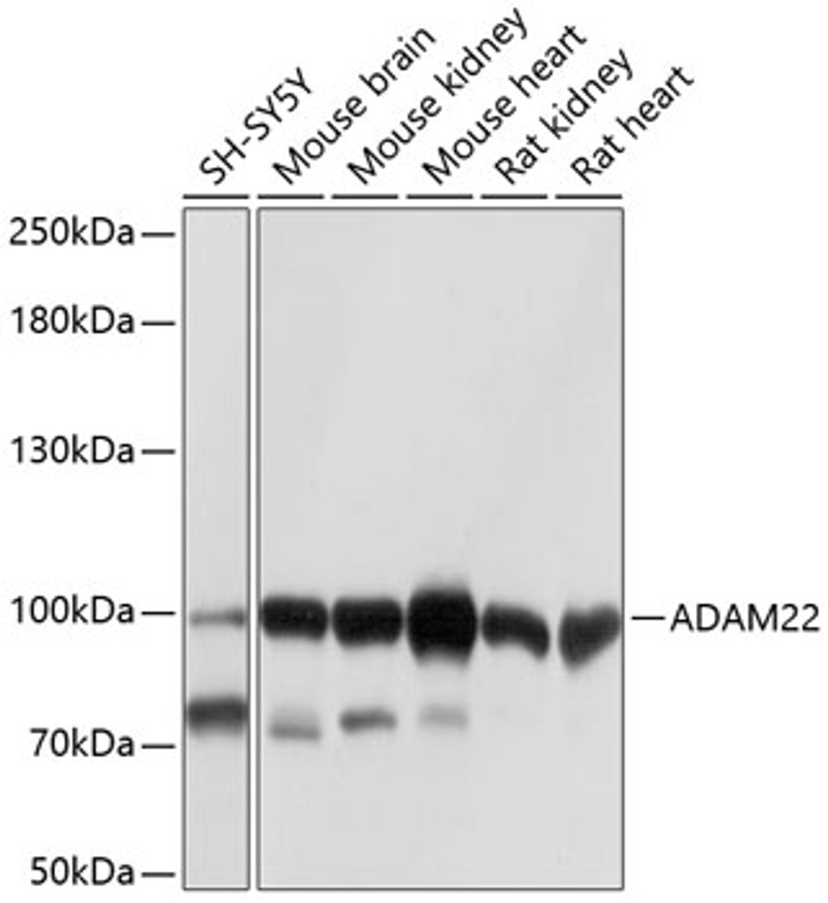 Western blot analysis of extracts of various cell lines, using ADAM22 antibody (13-385) at 1:1000 dilution.<br/>Secondary antibody: HRP Goat Anti-Rabbit IgG (H+L) at 1:10000 dilution.<br/>Lysates/proteins: 25ug per lane.<br/>Blocking buffer: 3% nonfat dry milk in TBST.<br/>Detection: ECL Basic Kit.<br/>Exposure time: 1s.