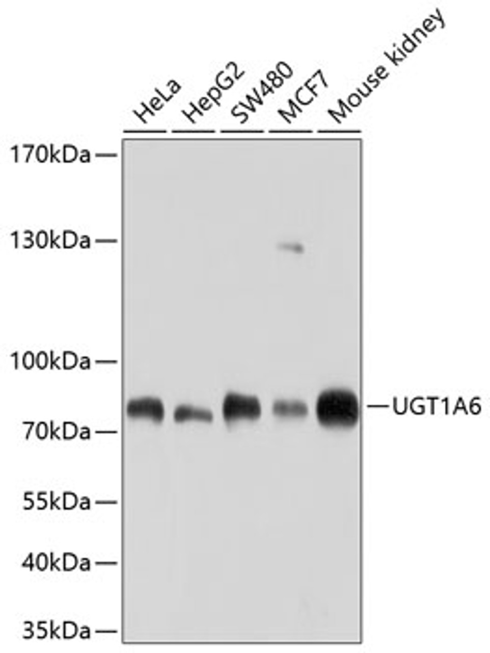 Western blot analysis of extracts of various cell lines, using UGT1A6 antibody (13-387) at 1:1000 dilution.<br/>Secondary antibody: HRP Goat Anti-Rabbit IgG (H+L) at 1:10000 dilution.<br/>Lysates/proteins: 25ug per lane.<br/>Blocking buffer: 3% nonfat dry milk in TBST.<br/>Detection: ECL Basic Kit.<br/>Exposure time: 60s.