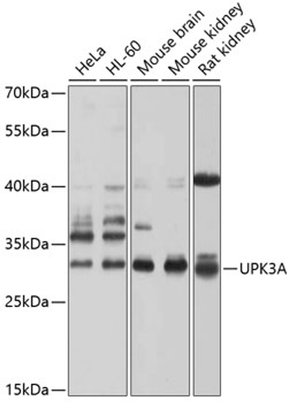 Western blot analysis of extracts of various cell lines, using UPK3A antibody (13-388) at 1:1000 dilution.<br/>Secondary antibody: HRP Goat Anti-Rabbit IgG (H+L) at 1:10000 dilution.<br/>Lysates/proteins: 25ug per lane.<br/>Blocking buffer: 3% nonfat dry milk in TBST.<br/>Detection: ECL Basic Kit.<br/>Exposure time: 5s.