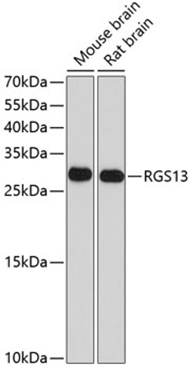 Western blot analysis of extracts of various cell lines, using RGS13 antibody (13-389) at 1:1000 dilution.<br/>Secondary antibody: HRP Goat Anti-Rabbit IgG (H+L) at 1:10000 dilution.<br/>Lysates/proteins: 25ug per lane.<br/>Blocking buffer: 3% nonfat dry milk in TBST.<br/>Detection: ECL Basic Kit.<br/>Exposure time: 90s.