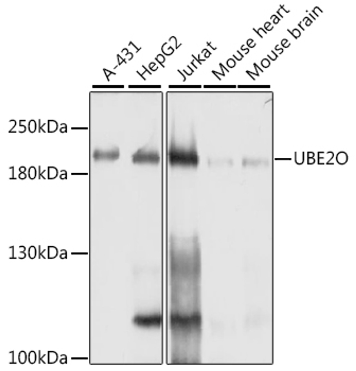 Western blot analysis of extracts of various cell lines, using UBE2O antibody (13-390) at 1:1000 dilution.<br/>Secondary antibody: HRP Goat Anti-Rabbit IgG (H+L) at 1:10000 dilution.<br/>Lysates/proteins: 25ug per lane.<br/>Blocking buffer: 3% nonfat dry milk in TBST.<br/>Detection: ECL Basic Kit.<br/>Exposure time: 1s.