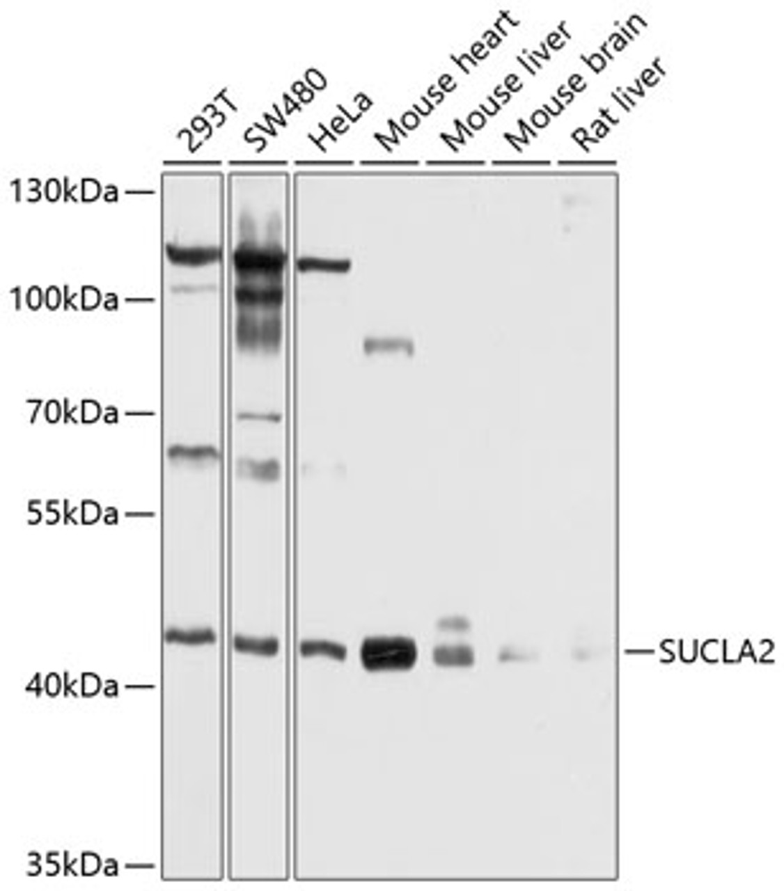 Western blot analysis of extracts of various cell lines, using SUCLA2 antibody (13-392) at 1:1000 dilution.<br/>Secondary antibody: HRP Goat Anti-Rabbit IgG (H+L) at 1:10000 dilution.<br/>Lysates/proteins: 25ug per lane.<br/>Blocking buffer: 3% nonfat dry milk in TBST.<br/>Detection: ECL Basic Kit.<br/>Exposure time: 1s.