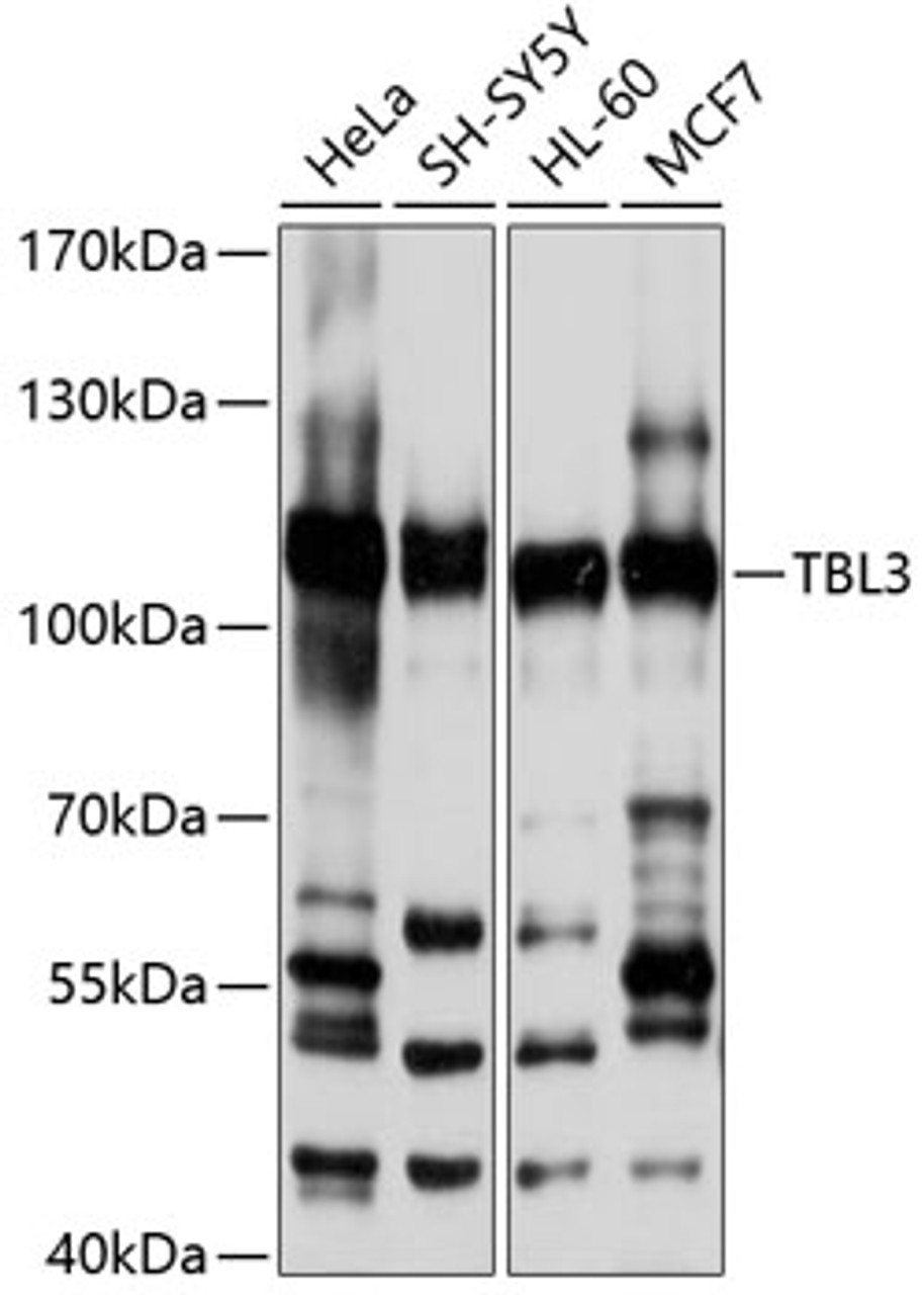 Western blot analysis of extracts of various cell lines, using TBL3 antibody (13-395) at 1:1000 dilution.<br/>Secondary antibody: HRP Goat Anti-Rabbit IgG (H+L) at 1:10000 dilution.<br/>Lysates/proteins: 25ug per lane.<br/>Blocking buffer: 3% nonfat dry milk in TBST.<br/>Detection: ECL Basic Kit.<br/>Exposure time: 10s.