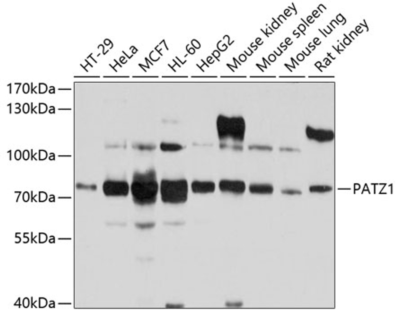 Western blot analysis of extracts of various cell lines, using PATZ1 antibody (13-398) at 1:1000 dilution.<br/>Secondary antibody: HRP Goat Anti-Rabbit IgG (H+L) at 1:10000 dilution.<br/>Lysates/proteins: 25ug per lane.<br/>Blocking buffer: 3% nonfat dry milk in TBST.<br/>Detection: ECL Basic Kit.<br/>Exposure time: 15s.