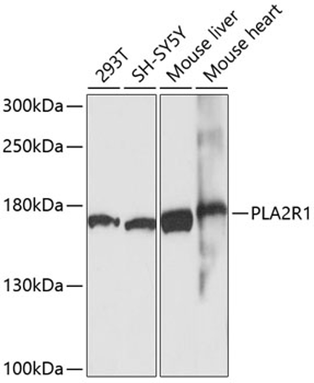 Western blot analysis of extracts of various cell lines, using PLA2R1 antibody (13-408) at 1:1000 dilution.<br/>Secondary antibody: HRP Goat Anti-Rabbit IgG (H+L) at 1:10000 dilution.<br/>Lysates/proteins: 25ug per lane.<br/>Blocking buffer: 3% nonfat dry milk in TBST.<br/>Detection: ECL Basic Kit.<br/>Exposure time: 90s.