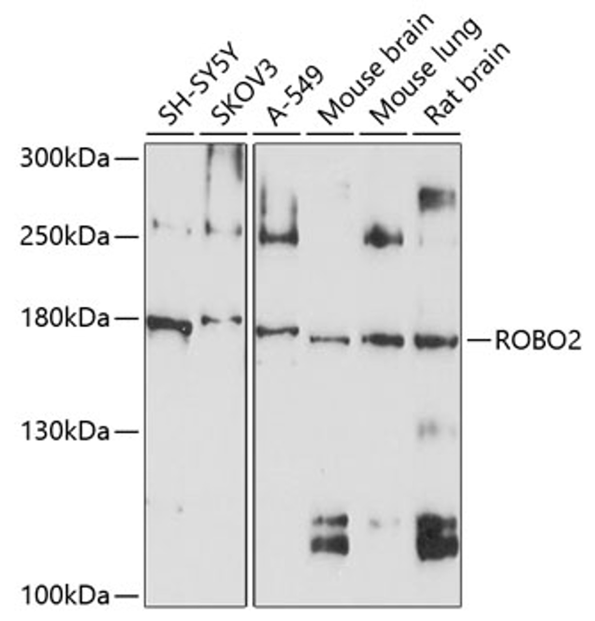 Western blot analysis of extracts of various cell lines, using ROBO2 antibody (13-410) at 1:1000 dilution._Secondary antibody: HRP Goat Anti-Rabbit IgG (H+L) at 1:10000 dilution._Lysates/proteins: 25ug per lane._Blocking buffer: 3% nonfat dry milk in TBST._Detection: ECL Enhanced Kit._Exposure time: 90s.