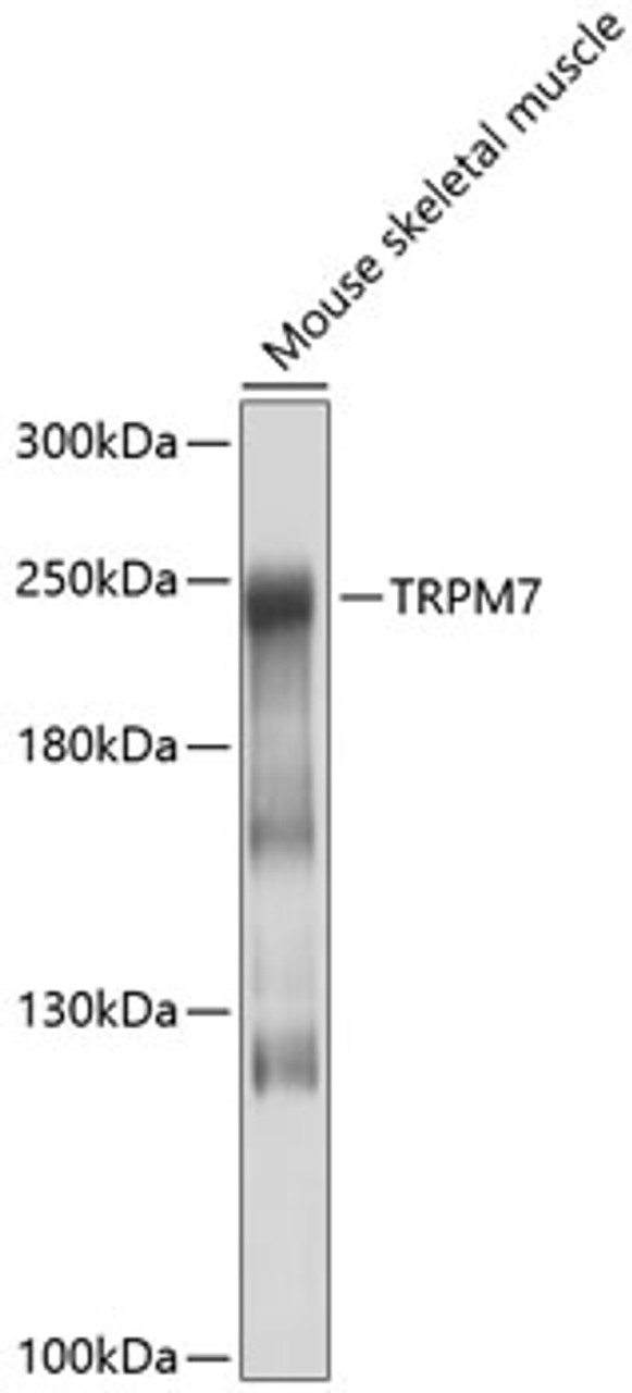 Western blot analysis of extracts of mouse skeletal muscle, using TRPM7 antibody (13-414) at 1:1000 dilution.<br/>Secondary antibody: HRP Goat Anti-Rabbit IgG (H+L) at 1:10000 dilution.<br/>Lysates/proteins: 25ug per lane.<br/>Blocking buffer: 3% nonfat dry milk in TBST.<br/>Detection: ECL Basic Kit.<br/>Exposure time: 10s.