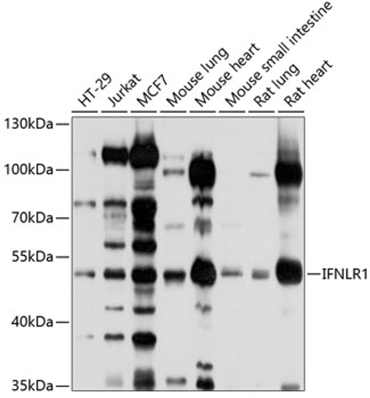 Western blot analysis of extracts of various cell lines, using IFNLR1 antibody (13-419) at 1:1000 dilution.<br/>Secondary antibody: HRP Goat Anti-Rabbit IgG (H+L) at 1:10000 dilution.<br/>Lysates/proteins: 25ug per lane.<br/>Blocking buffer: 3% nonfat dry milk in TBST.<br/>Detection: ECL Basic Kit.<br/>Exposure time: 10s.