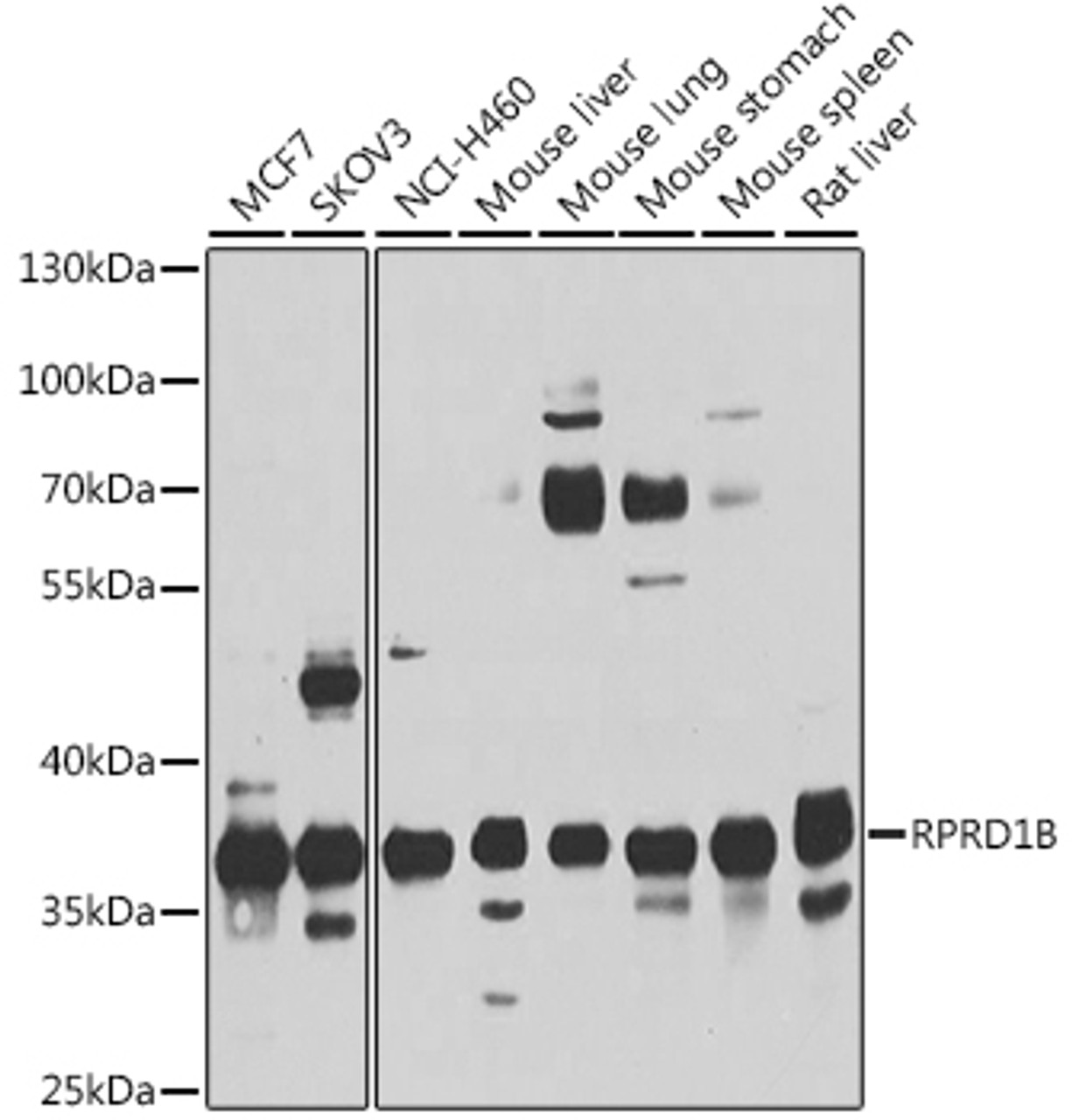 Western blot analysis of extracts of various cell lines, using rprd1b antibody (13-430) at 1:1000 dilution.<br/>Secondary antibody: HRP Goat Anti-Rabbit IgG (H+L) at 1:10000 dilution.<br/>Lysates/proteins: 25ug per lane.<br/>Blocking buffer: 3% nonfat dry milk in TBST.<br/>Detection: ECL Basic Kit.<br/>Exposure time: 15s.