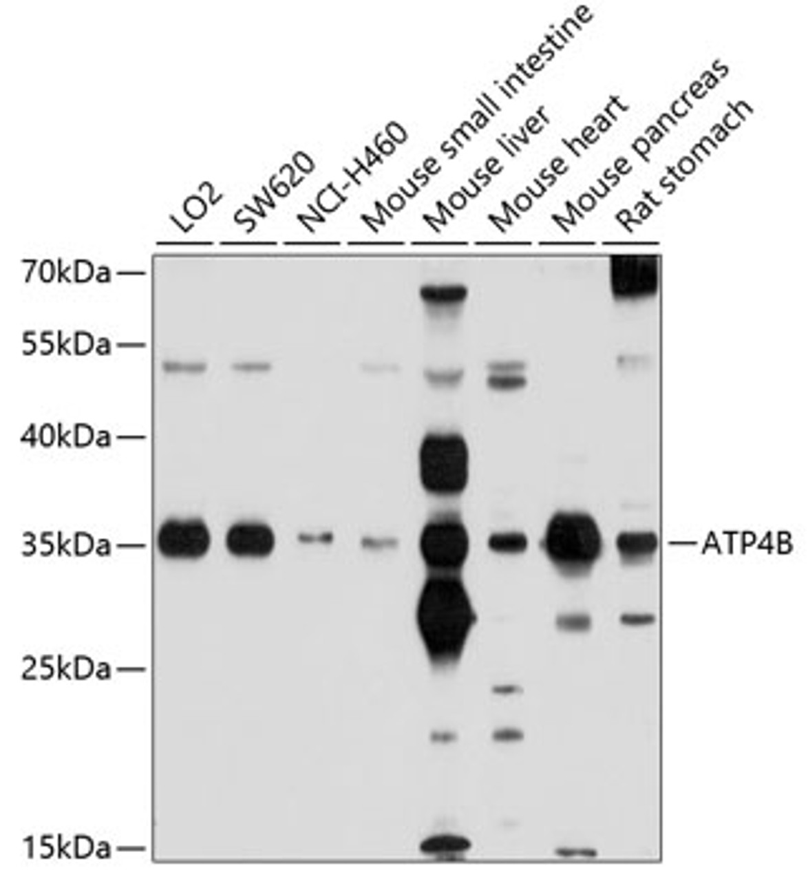 Western blot analysis of extracts of various cell lines, using ATP4B antibody (13-431) at 1:1000 dilution.<br/>Secondary antibody: HRP Goat Anti-Rabbit IgG (H+L) at 1:10000 dilution.<br/>Lysates/proteins: 25ug per lane.<br/>Blocking buffer: 3% nonfat dry milk in TBST.<br/>Detection: ECL Basic Kit.<br/>Exposure time: 30s.