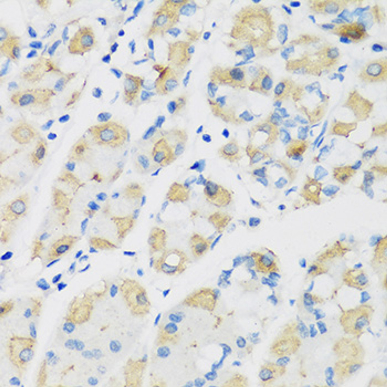 Immunohistochemistry of paraffin-embedded human stomach using ATP4B antibody (13-431) at dilution of 1:100 (40x lens) .