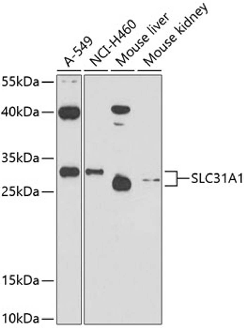 Western blot analysis of extracts of various cell lines, using SLC31A1 antibody (13-433) at 1:1000 dilution.<br/>Secondary antibody: HRP Goat Anti-Rabbit IgG (H+L) at 1:10000 dilution.<br/>Lysates/proteins: 25ug per lane.<br/>Blocking buffer: 3% nonfat dry milk in TBST.<br/>Detection: ECL Basic Kit.<br/>Exposure time: 90s.