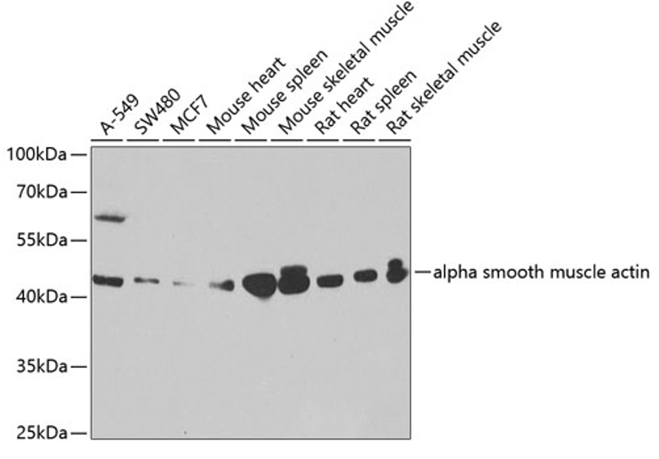 Western blot analysis of extracts of various cell lines, using alpha smooth muscle actin antibody (13-434) at 1:1000 dilution.<br/>Secondary antibody: HRP Goat Anti-Rabbit IgG (H+L) at 1:10000 dilution.<br/>Lysates/proteins: 25ug per lane.<br/>Blocking buffer: 3% nonfat dry milk in TBST.<br/>Detection: ECL Basic Kit.<br/>Exposure time: 30s.