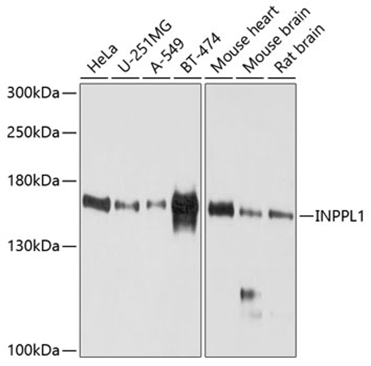 Western blot analysis of extracts of various cell lines, using INPPL1 antibody (13-439) at 1:1000 dilution.<br/>Secondary antibody: HRP Goat Anti-Rabbit IgG (H+L) at 1:10000 dilution.<br/>Lysates/proteins: 25ug per lane.<br/>Blocking buffer: 3% nonfat dry milk in TBST.<br/>Detection: ECL Basic Kit.<br/>Exposure time: 60s.