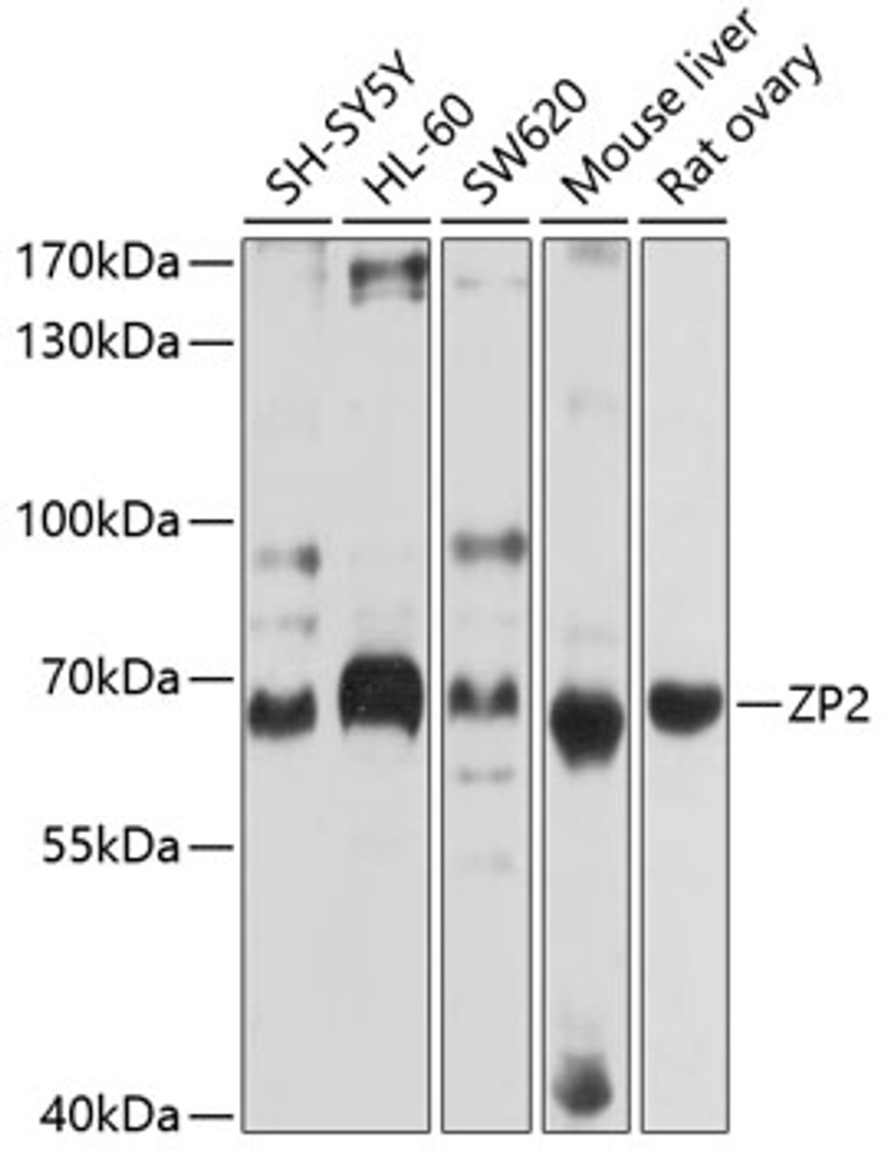 Western blot analysis of extracts of various cell lines, using ZP2 antibody (13-444) at 1:1000 dilution.<br/>Secondary antibody: HRP Goat Anti-Rabbit IgG (H+L) at 1:10000 dilution.<br/>Lysates/proteins: 25ug per lane.<br/>Blocking buffer: 3% nonfat dry milk in TBST.<br/>Detection: ECL Basic Kit.<br/>Exposure time: 10s.