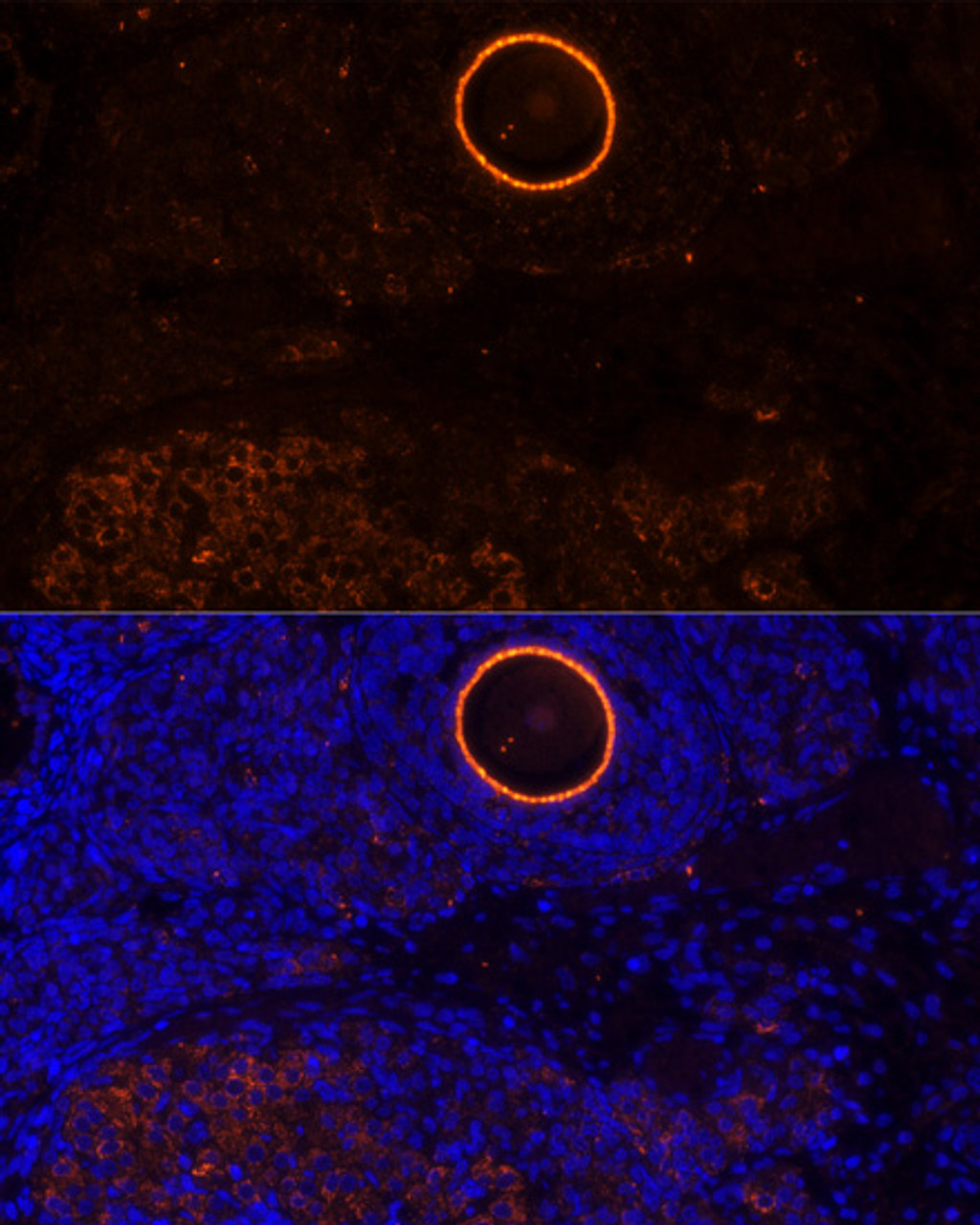 Immunofluorescence analysis of rat oophoroma cells using ZP2 antibody (13-444) at dilution of 1:100. Blue: DAPI for nuclear staining.
