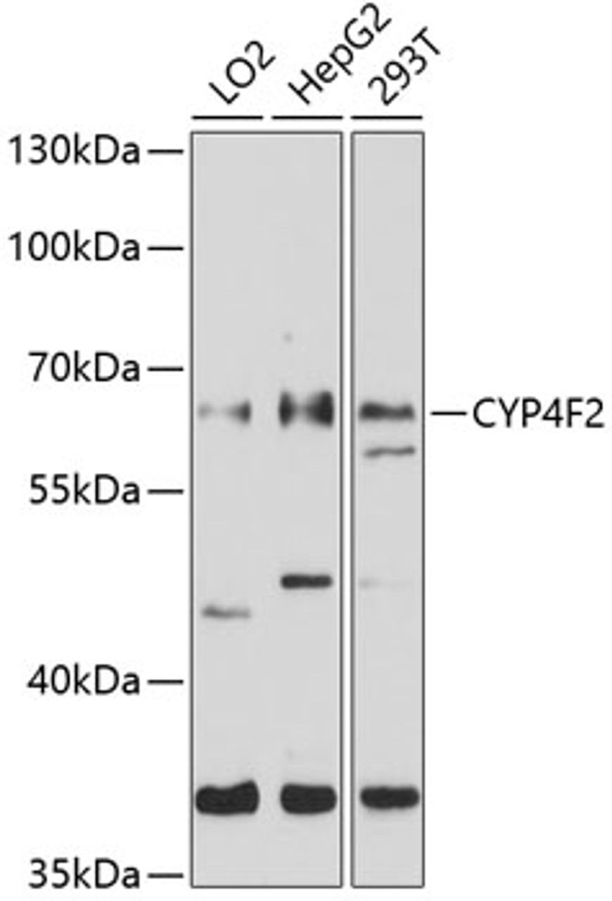 Western blot analysis of extracts of various cell lines, using CYP4F2 antibody (13-445) at 1:1000 dilution.<br/>Secondary antibody: HRP Goat Anti-Rabbit IgG (H+L) at 1:10000 dilution.<br/>Lysates/proteins: 25ug per lane.<br/>Blocking buffer: 3% nonfat dry milk in TBST.<br/>Detection: ECL Basic Kit.<br/>Exposure time: 5s.