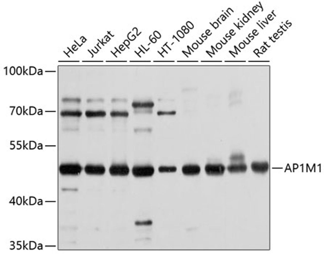Western blot analysis of extracts of various cell lines, using AP1M1 antibody (13-446) at 1:1000 dilution.<br/>Secondary antibody: HRP Goat Anti-Rabbit IgG (H+L) at 1:10000 dilution.<br/>Lysates/proteins: 25ug per lane.<br/>Blocking buffer: 3% nonfat dry milk in TBST.<br/>Detection: ECL Basic Kit.<br/>Exposure time: 30s.