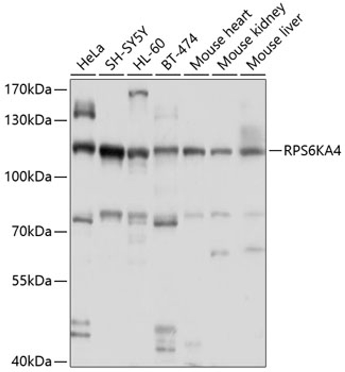 Western blot analysis of extracts of various cell lines, using RPS6KA4 antibody (13-447) at 1:1000 dilution.<br/>Secondary antibody: HRP Goat Anti-Rabbit IgG (H+L) at 1:10000 dilution.<br/>Lysates/proteins: 25ug per lane.<br/>Blocking buffer: 3% nonfat dry milk in TBST.<br/>Detection: ECL Basic Kit.<br/>Exposure time: 60s.