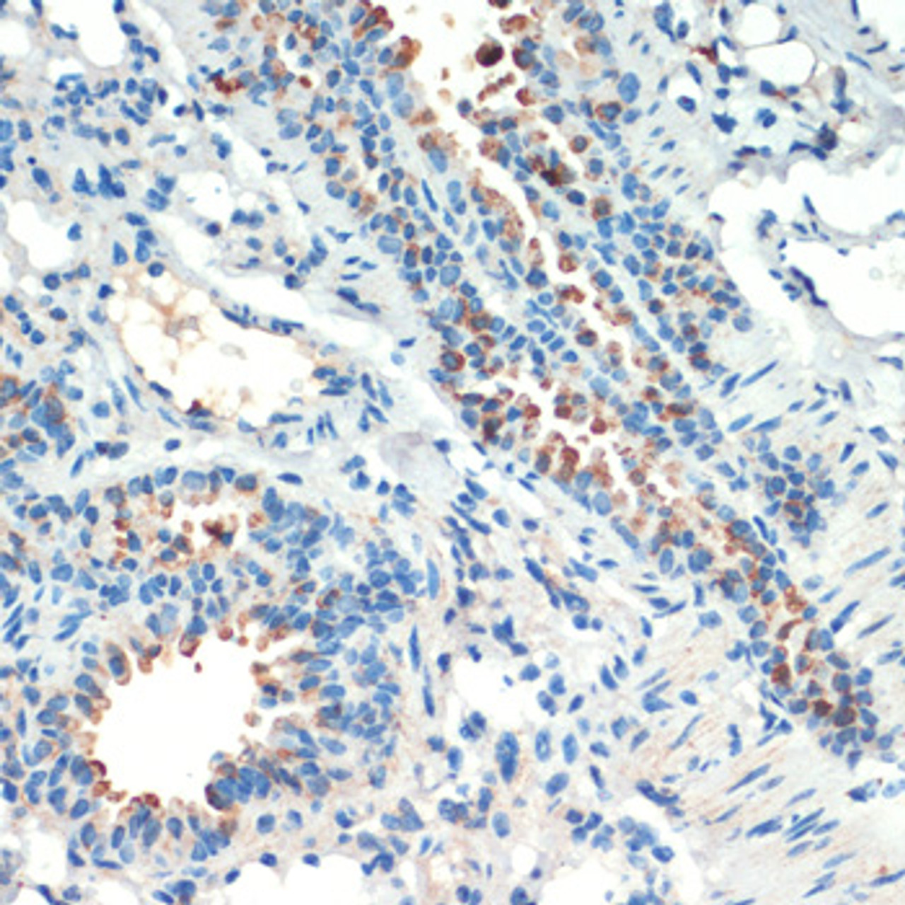 Immunohistochemistry of paraffin-embedded mouse lung using RPS6KA4 antibody (13-447) at dilution of 1:200 (40x lens) .