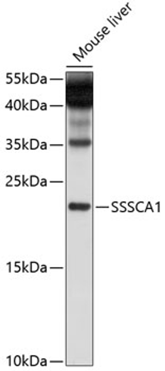 Western blot analysis of extracts of mouse liver, using SSSCA1 antibody (13-450) at 1:1000 dilution.<br/>Secondary antibody: HRP Goat Anti-Rabbit IgG (H+L) at 1:10000 dilution.<br/>Lysates/proteins: 25ug per lane.<br/>Blocking buffer: 3% nonfat dry milk in TBST.<br/>Detection: ECL Basic Kit.<br/>Exposure time: 10s.