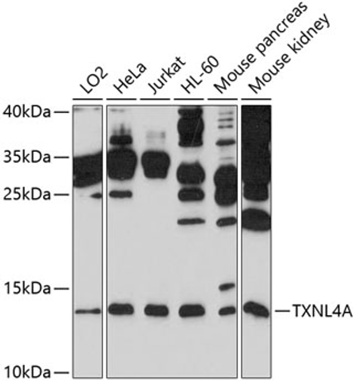 Western blot analysis of extracts of various cell lines, using TXNL4A antibody (13-451) at 1:1000 dilution.<br/>Secondary antibody: HRP Goat Anti-Rabbit IgG (H+L) at 1:10000 dilution.<br/>Lysates/proteins: 25ug per lane.<br/>Blocking buffer: 3% nonfat dry milk in TBST.<br/>Detection: ECL Basic Kit.<br/>Exposure time: 90s.