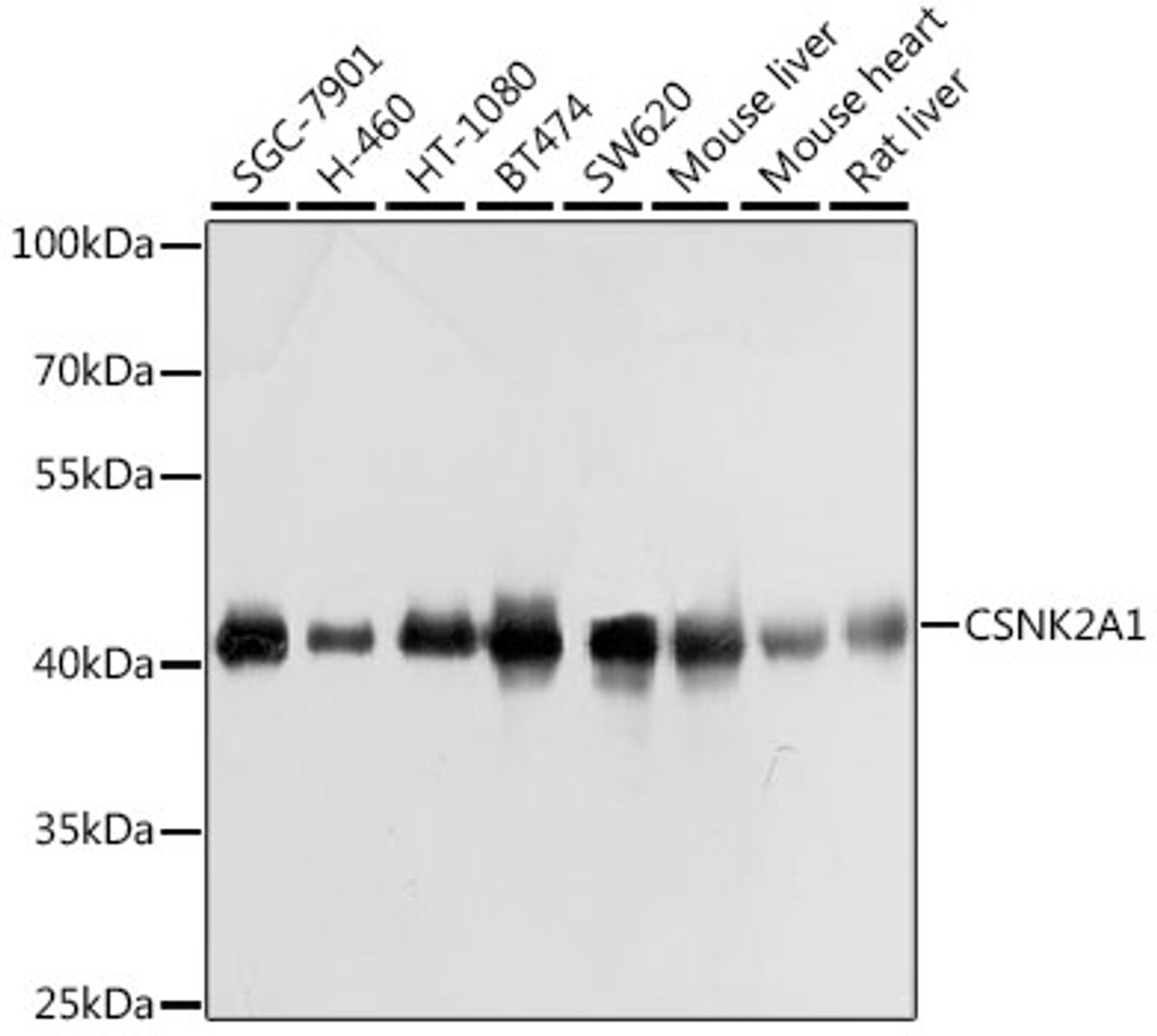 Western blot analysis of extracts of various cell lines, using CSNK2A1 antibody (13-453) at 1:1000 dilution.<br/>Secondary antibody: HRP Goat Anti-Rabbit IgG (H+L) at 1:10000 dilution.<br/>Lysates/proteins: 25ug per lane.<br/>Blocking buffer: 3% nonfat dry milk in TBST.<br/>Detection: ECL Basic Kit.<br/>Exposure time: 1s.