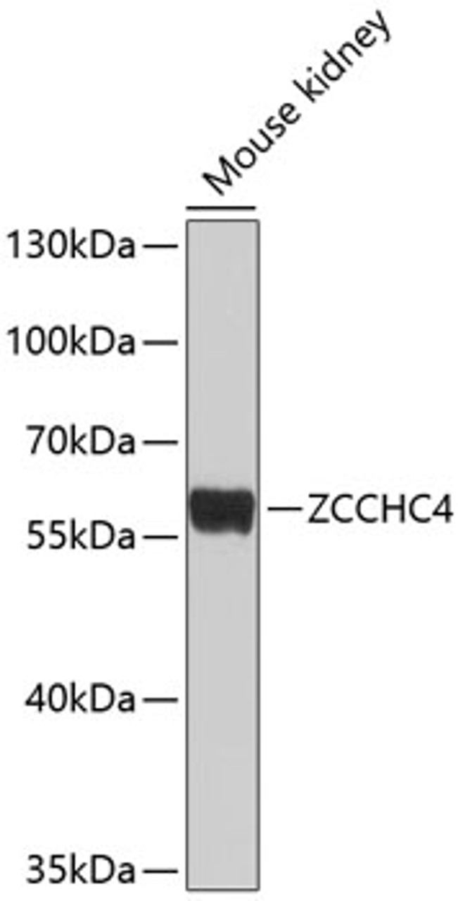 Western blot analysis of extracts of mouse kidney, using ZCCHC4 antibody (13-458) at 1:1000 dilution.<br/>Secondary antibody: HRP Goat Anti-Rabbit IgG (H+L) at 1:10000 dilution.<br/>Lysates/proteins: 25ug per lane.<br/>Blocking buffer: 3% nonfat dry milk in TBST.<br/>Detection: ECL Basic Kit.<br/>Exposure time: 30s.