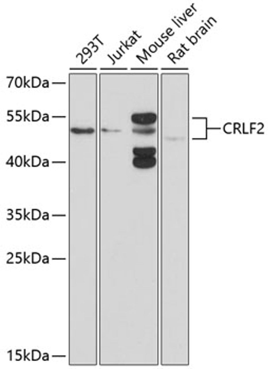 Western blot analysis of extracts of various cell lines, using CRLF2 antibody (13-466) at 1:1000 dilution.<br/>Secondary antibody: HRP Goat Anti-Rabbit IgG (H+L) at 1:10000 dilution.<br/>Lysates/proteins: 25ug per lane.<br/>Blocking buffer: 3% nonfat dry milk in TBST.<br/>Detection: ECL Basic Kit.<br/>Exposure time: 90s.