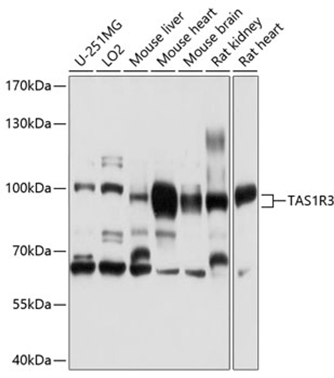 Western blot analysis of extracts of various cell lines, using TAS1R3 antibody (13-470) at 1:1000 dilution.<br/>Secondary antibody: HRP Goat Anti-Rabbit IgG (H+L) at 1:10000 dilution.<br/>Lysates/proteins: 25ug per lane.<br/>Blocking buffer: 3% nonfat dry milk in TBST.<br/>Detection: ECL Basic Kit.<br/>Exposure time: 5s.