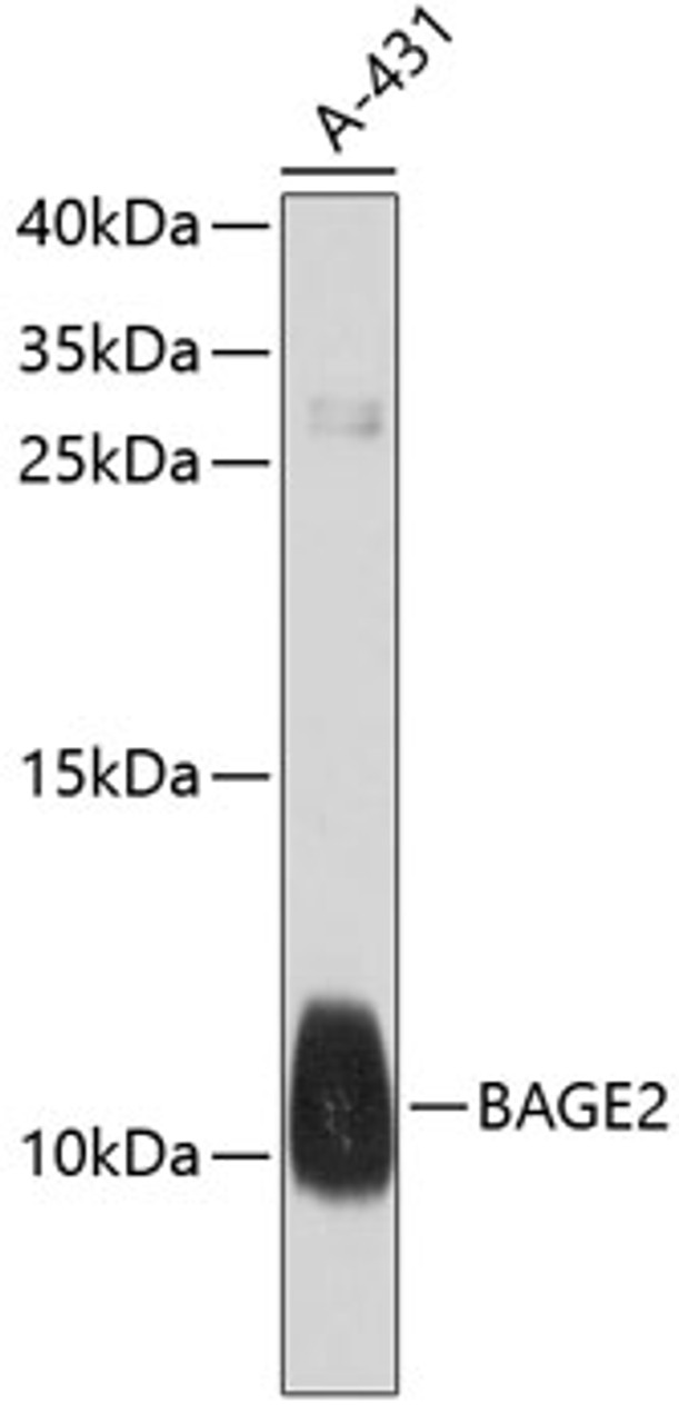 Western blot analysis of extracts of A-431 cells, using BAGE2 antibody (13-472) at 1:1000 dilution.<br/>Secondary antibody: HRP Goat Anti-Rabbit IgG (H+L) at 1:10000 dilution.<br/>Lysates/proteins: 25ug per lane.<br/>Blocking buffer: 3% nonfat dry milk in TBST.<br/>Detection: ECL Basic Kit.<br/>Exposure time: 90s.