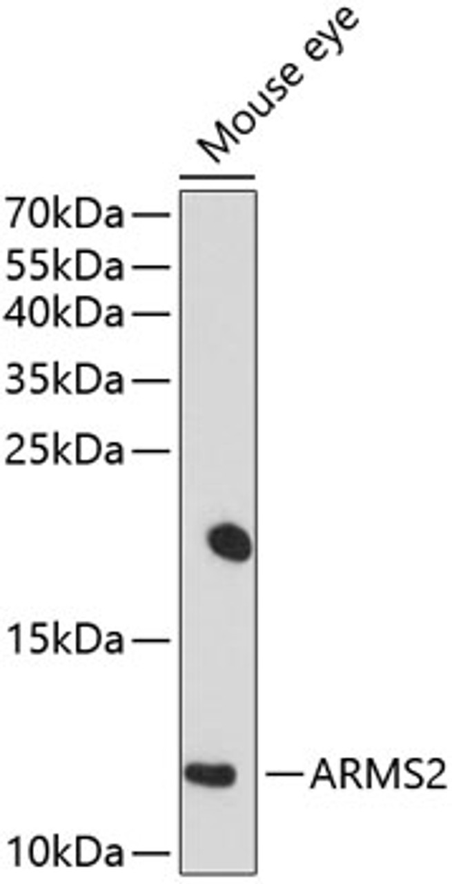 Western blot analysis of extracts of mouse eye, using ARMS2 antibody (13-474) at 1:1000 dilution.<br/>Secondary antibody: HRP Goat Anti-Rabbit IgG (H+L) at 1:10000 dilution.<br/>Lysates/proteins: 25ug per lane.<br/>Blocking buffer: 3% nonfat dry milk in TBST.<br/>Detection: ECL Basic Kit.<br/>Exposure time: 90s.