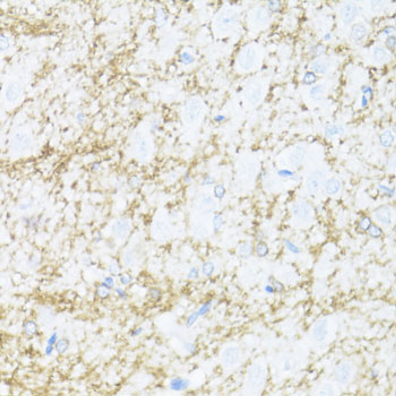 Immunohistochemistry of paraffin-embedded rat brain using CNP antibody (13-482) at dilution of 1:100 (40x lens) .